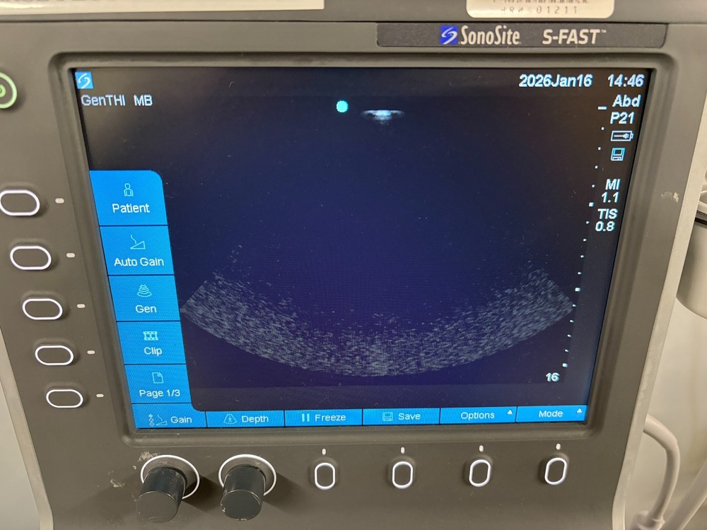 2014 SonoSite S-FAST Ultrasound System