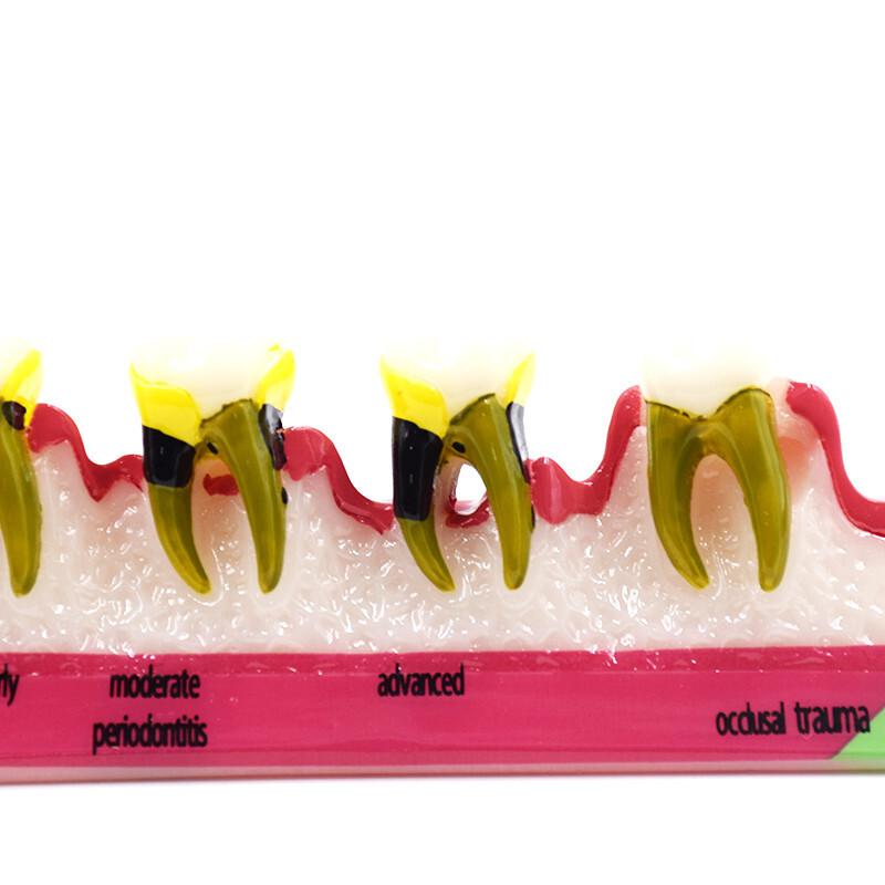 Dental High Quality Assort Dentoform Pathological Study Periodontal Model Teeth