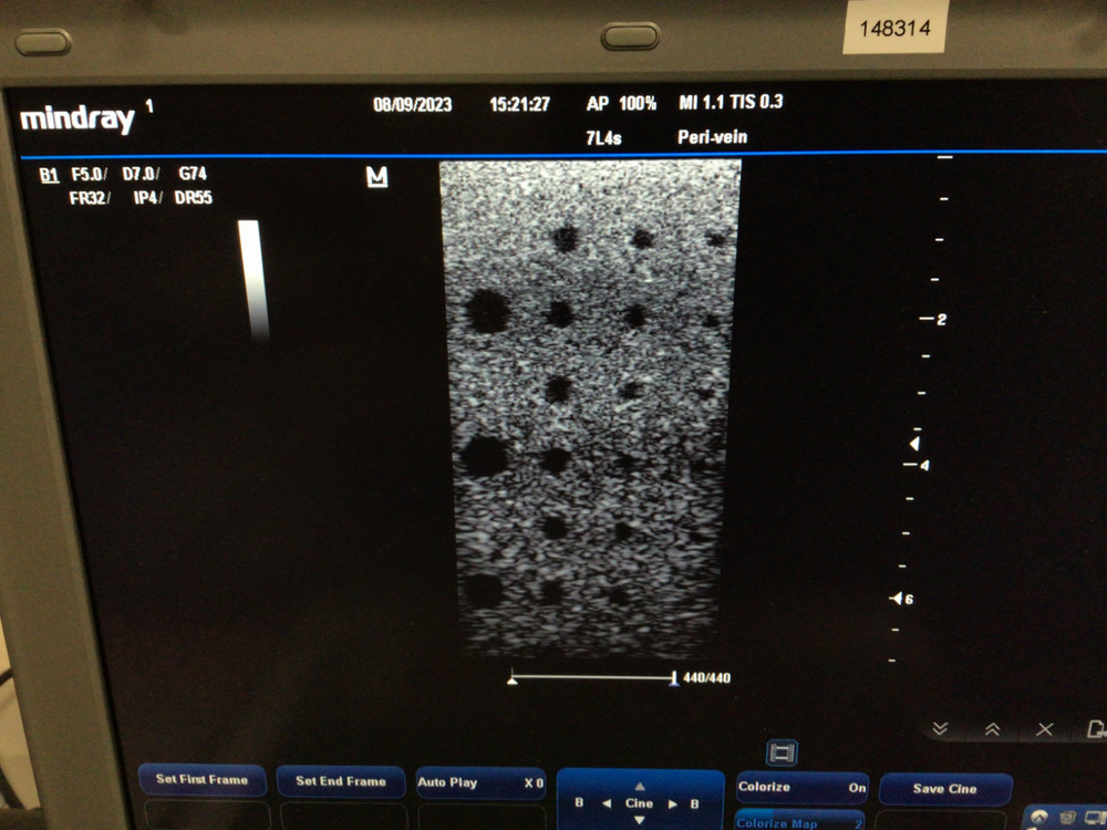 Mindray 7L4s Linear Array Ultrasound Probe
