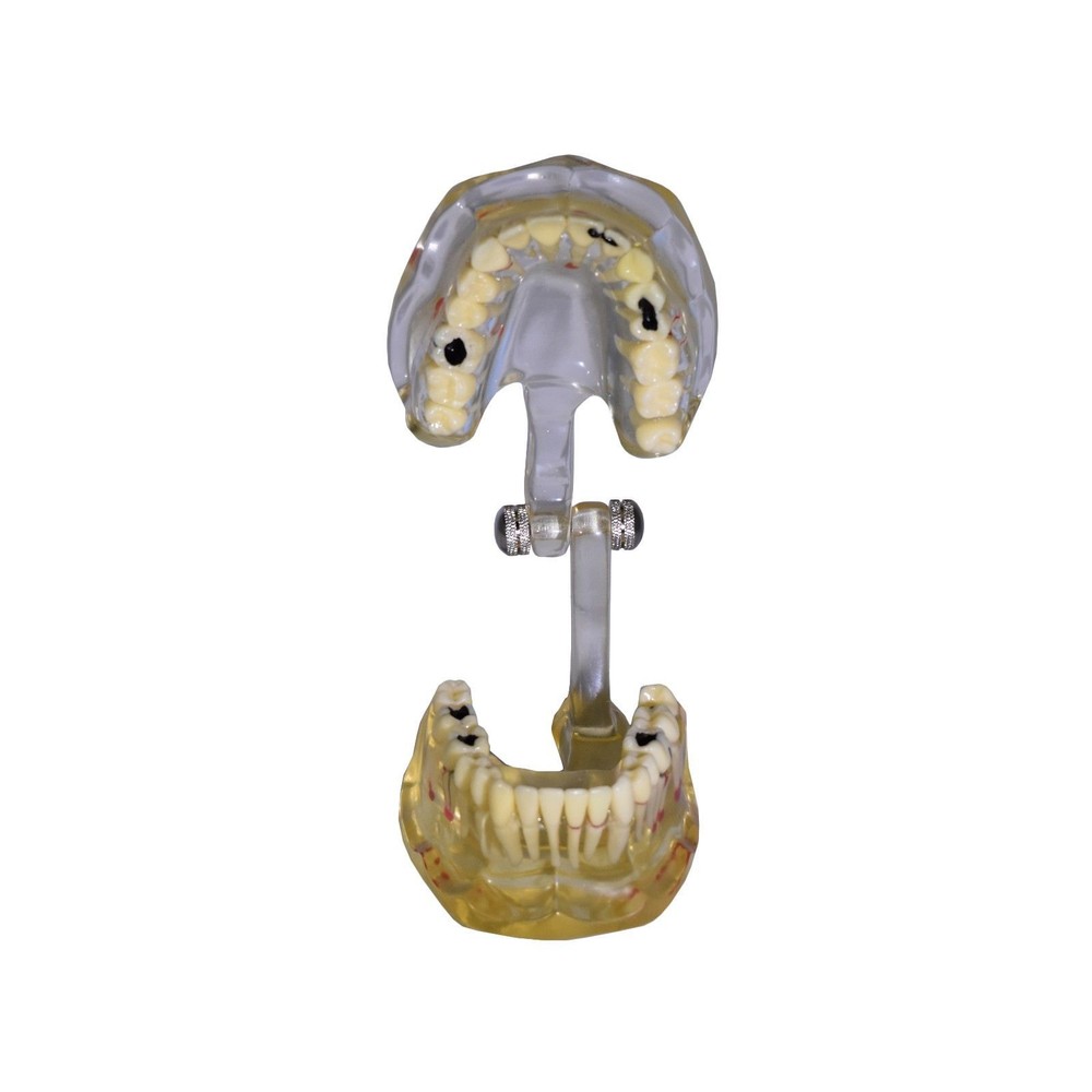 REDLAND Model Dental Demonstration Teeth Educational Model