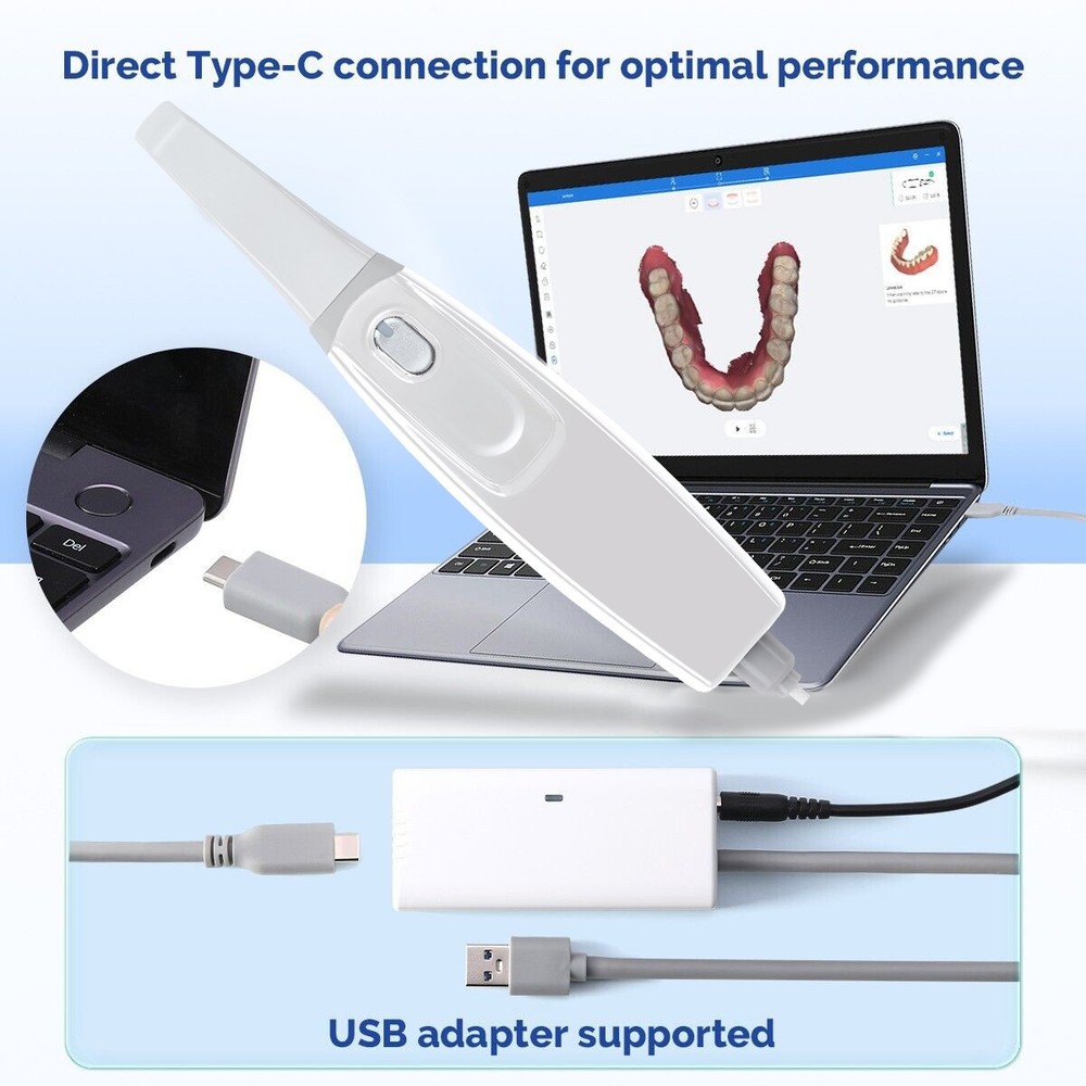 Dental Intra-oral 3D Scanner with Scanning Software