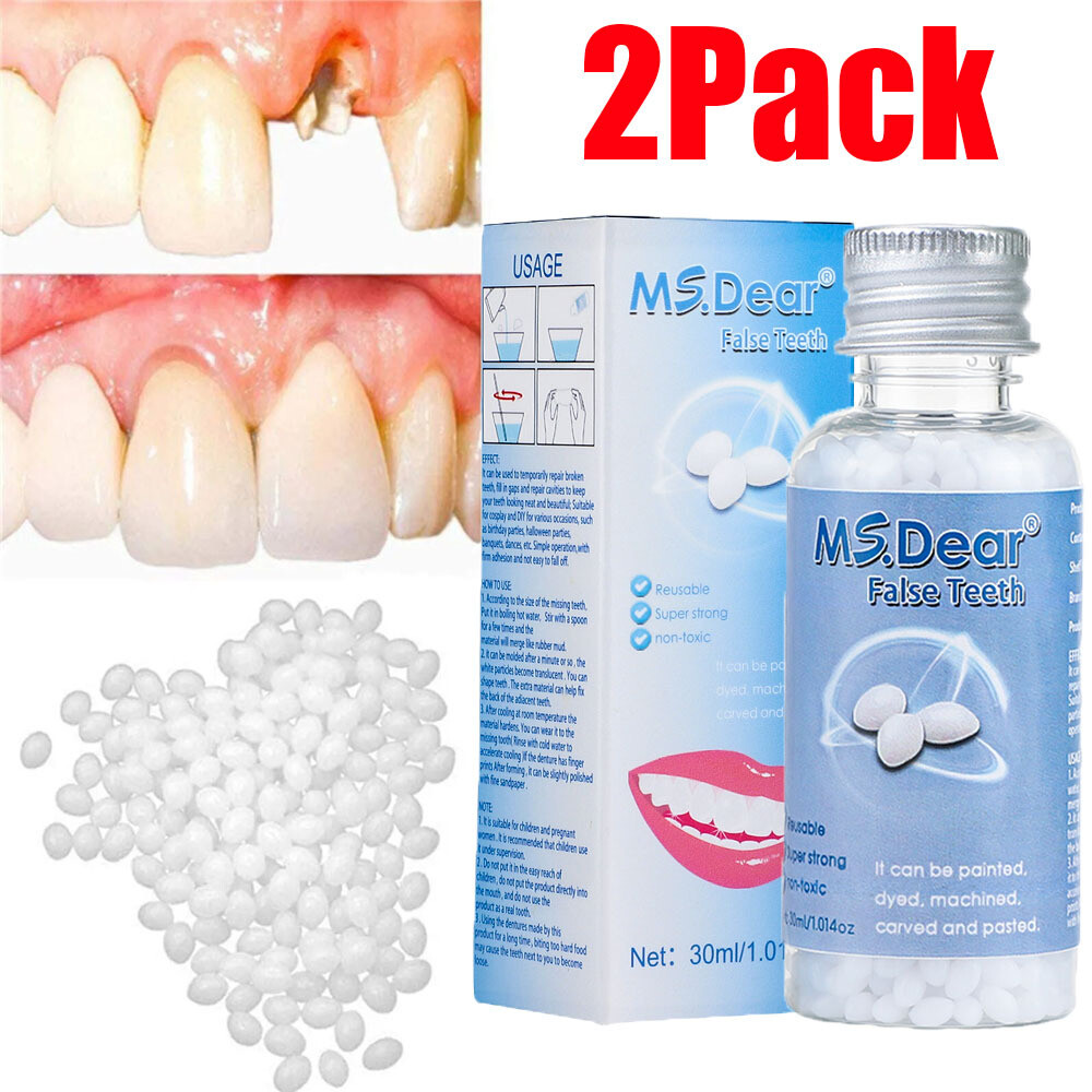 2PCS Tooth Repair Granules Temporary Reusable Moldable False Teeth Fitting Beads