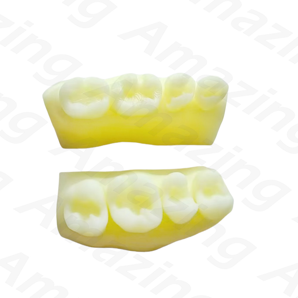 Dental Caries Decay Teeth Model Composite Resin Restore Tooth Simulate Class II
