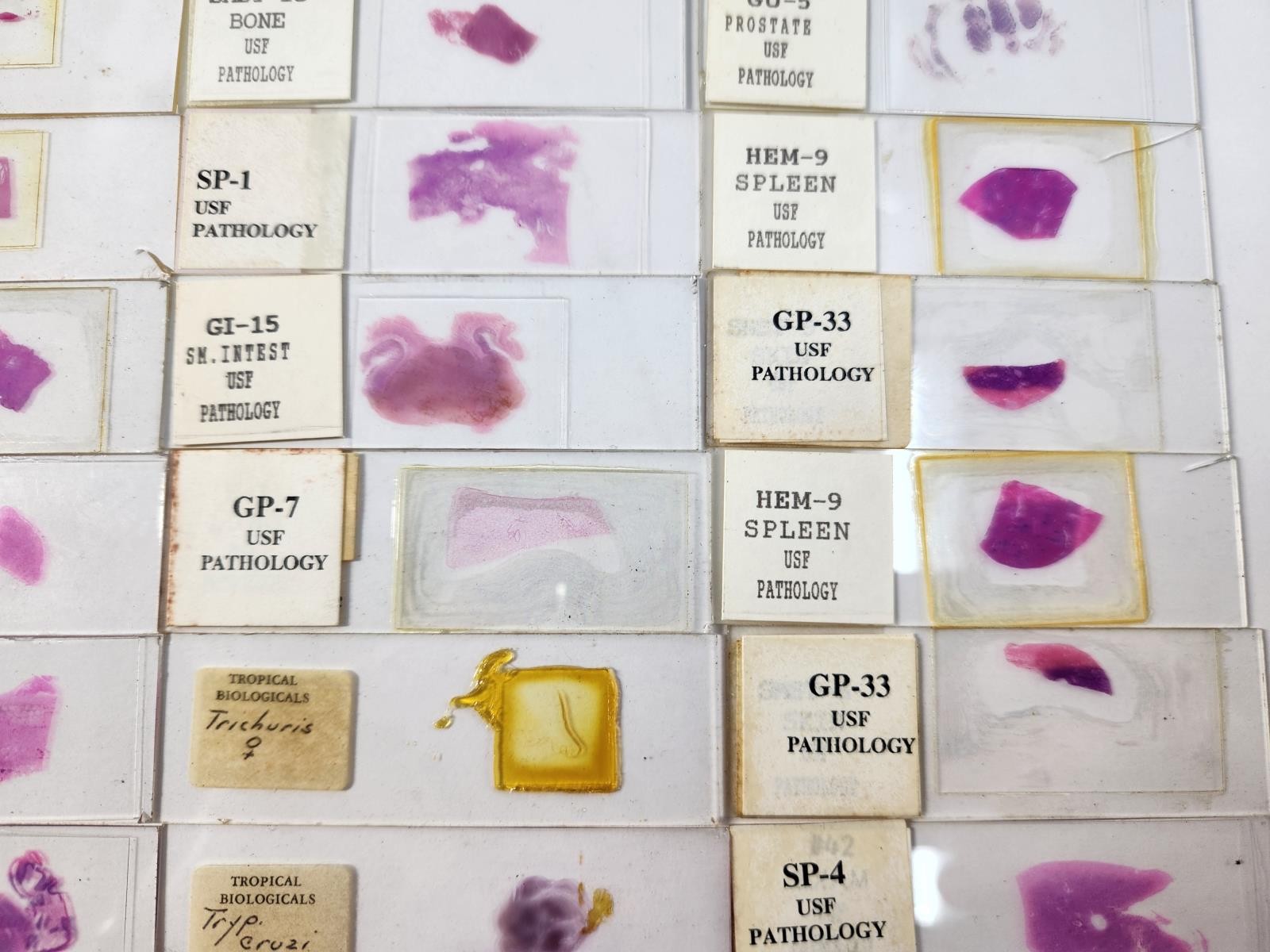 Lot Of 50 Vintage University Prepared Pathology Microscope Slides - Slides Only