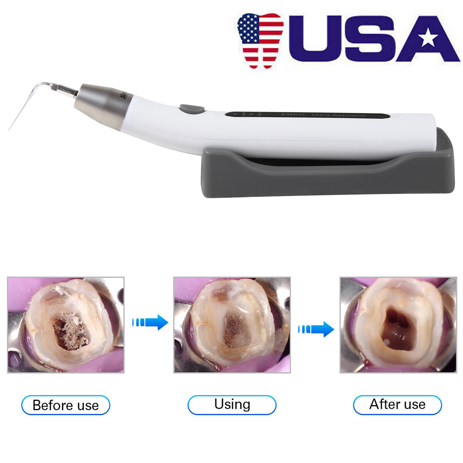 Dental Endo Ultra Activator Ultrasonic Irrigator Root Canal Scaling Handpiece