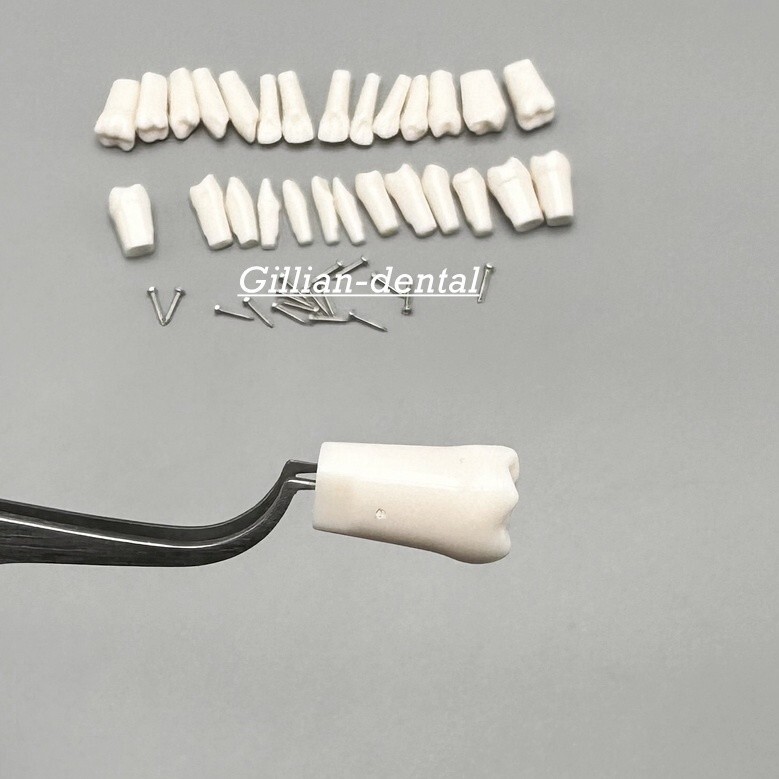 Dental Replacement Screw-in Teeth Typodont Model Practice Removable Tooth Models
