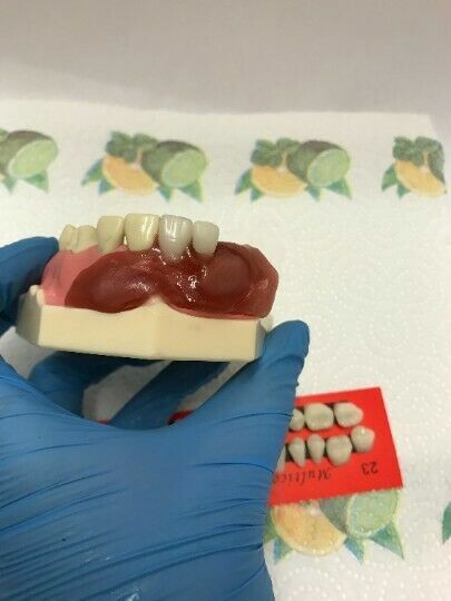 DIY Denture Kit Immediate Partial Denture, Full Denture Upper OR Lower NO MOLD