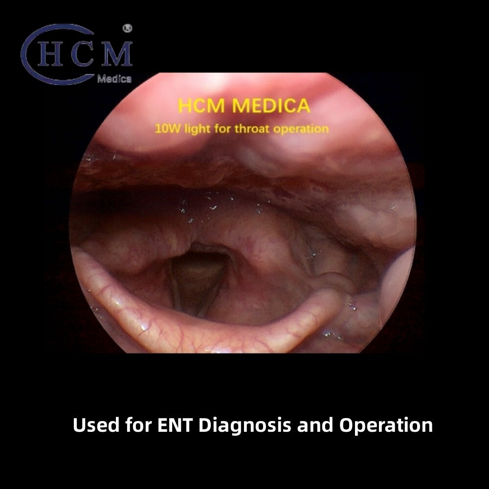 Rechargeable Portable Endoscope Light Source 10W LED Cold Light Source For ENT