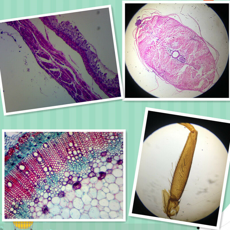 Prepared Microscope Slides Specimen Glass Set with Plastic Storage Box & Label