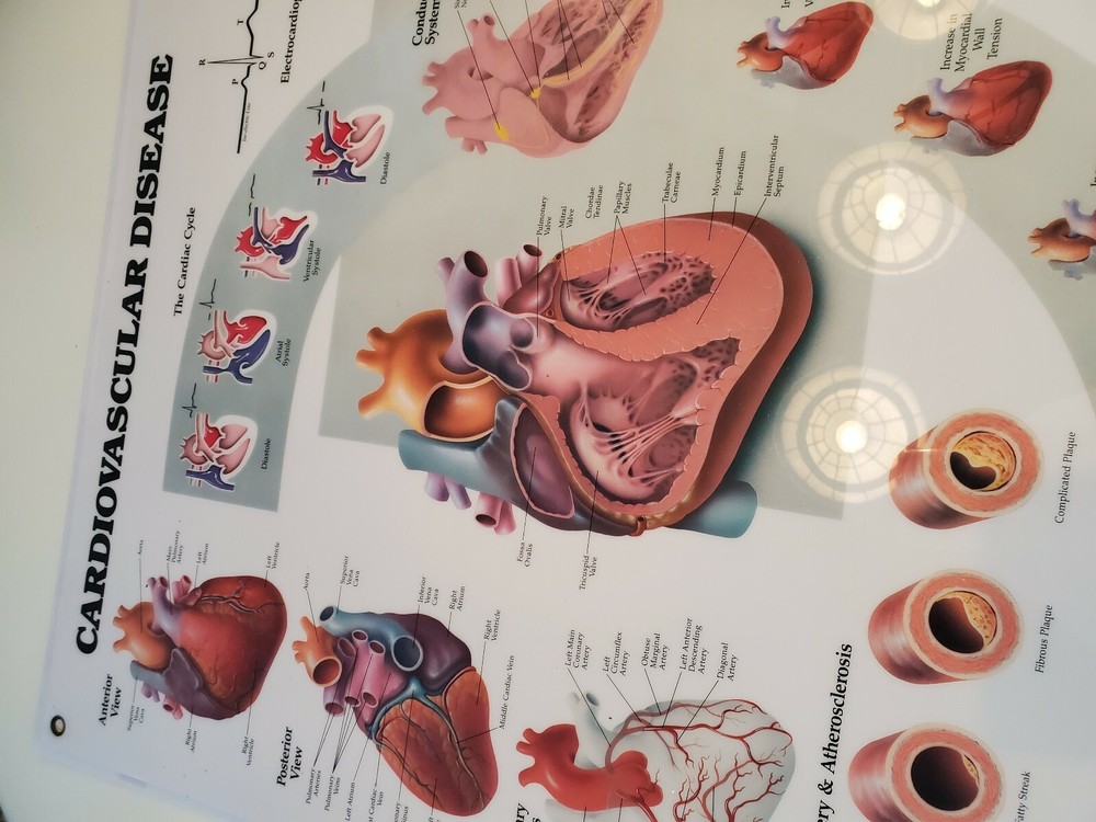 2 Medical Flip Chart Sheets Cardiovascular