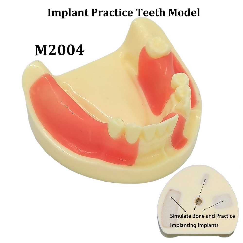 Dental Implant Practice Teeth Model Cutting Suturing Typodont M2004