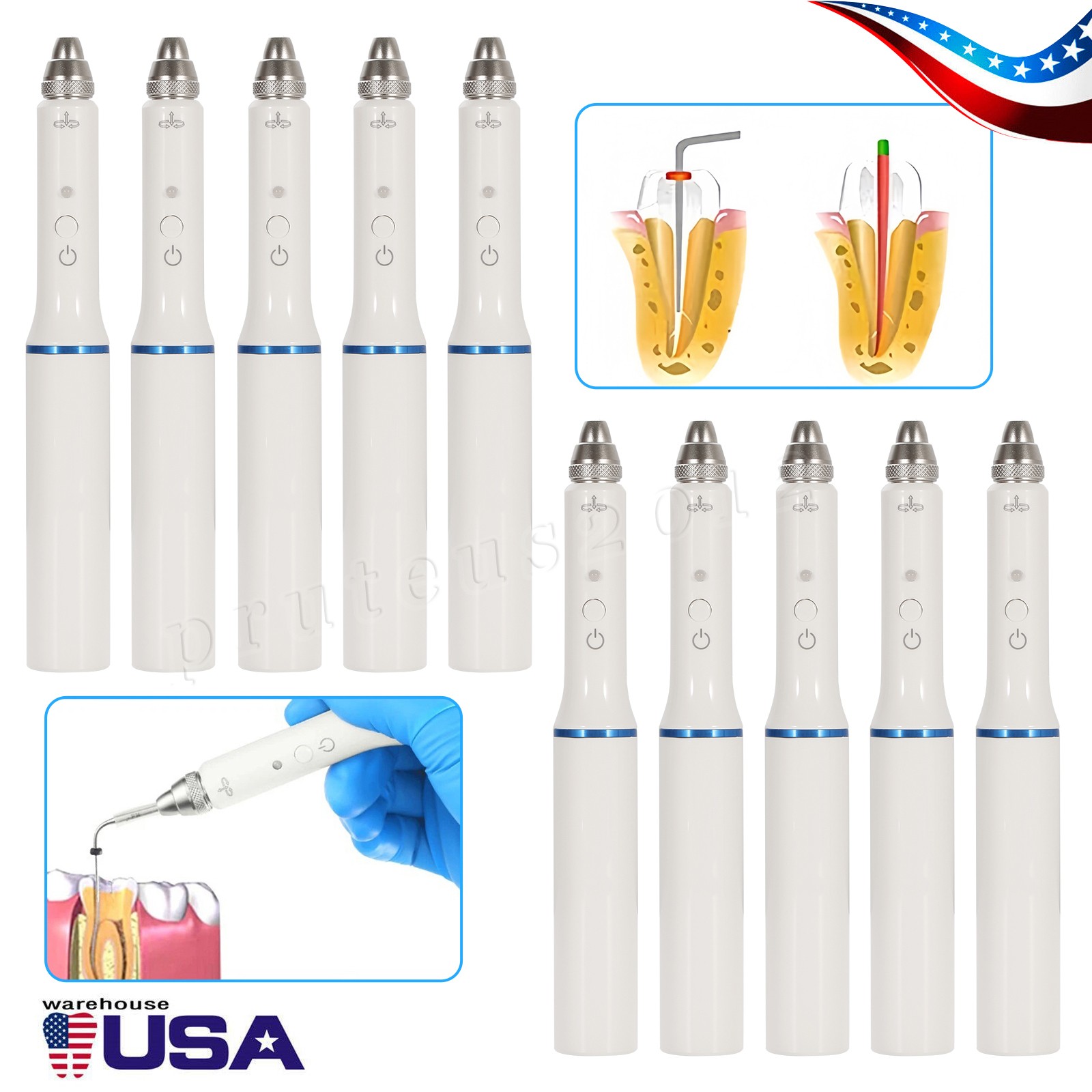 Dental Gutta Percha Obturation System Wireless Endo Heated Pen+2Tips