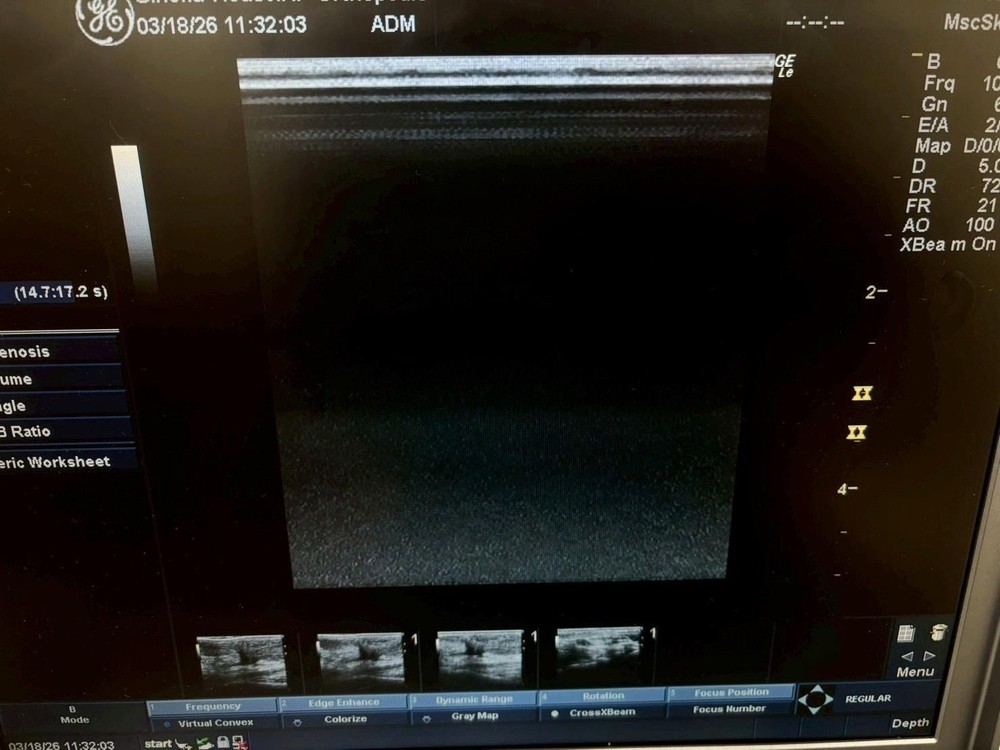 Ge ultrasound probe Linear 9LRS