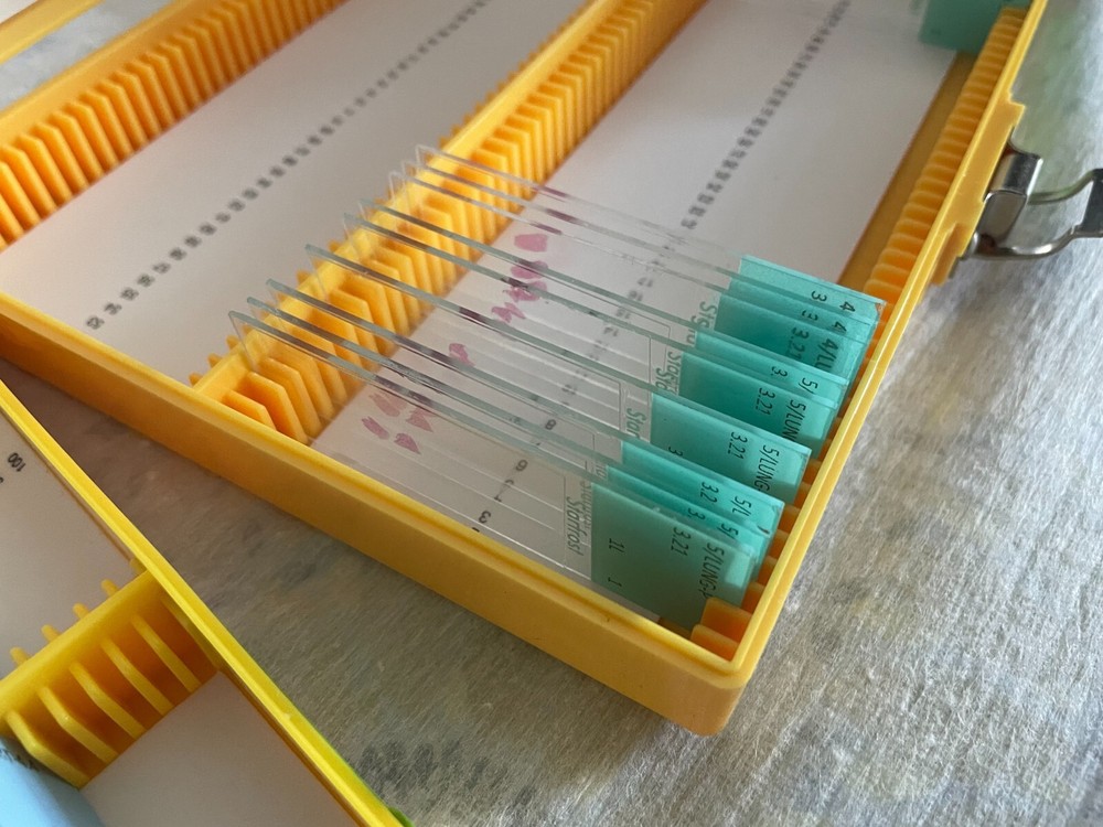 Two Microscope storage boxes with mouse tissues slides