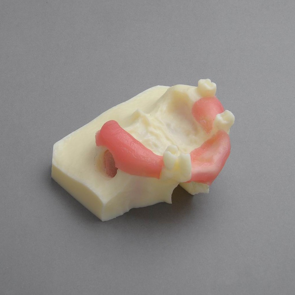 Dental Model #2013 01 - Sinus Lift Practice Model