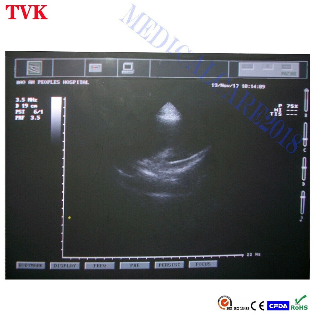 Mindray 75L38EA Linear Array Probe for Z5, DP-30, DP-50, Compatible Transducer