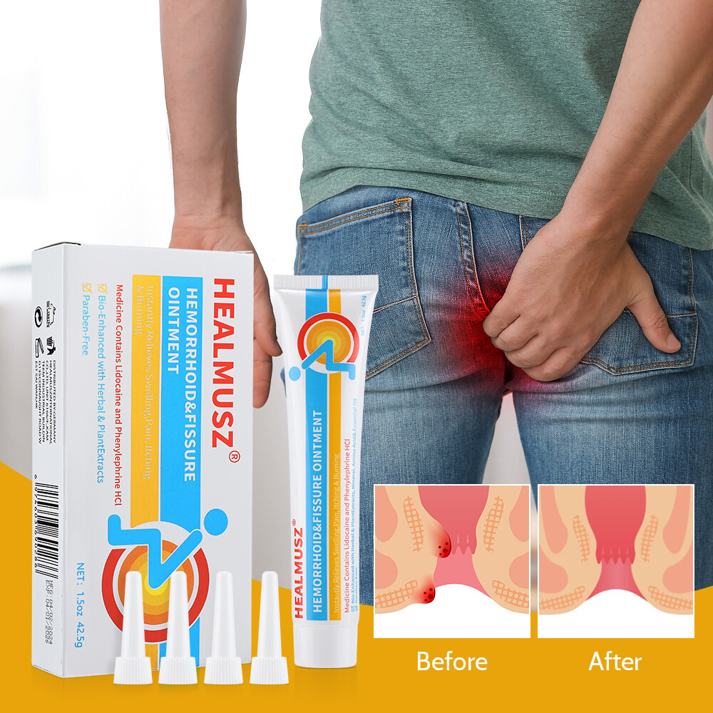 Hemorrhoids Remove Ointment Herbal Cream Relief Piles Pain Reduce Itching 42.5g