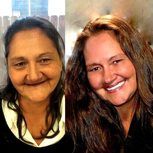 DIY DENTURE KIT Custom Homemade Dentures For Begginers * FULL /PARTIAL*