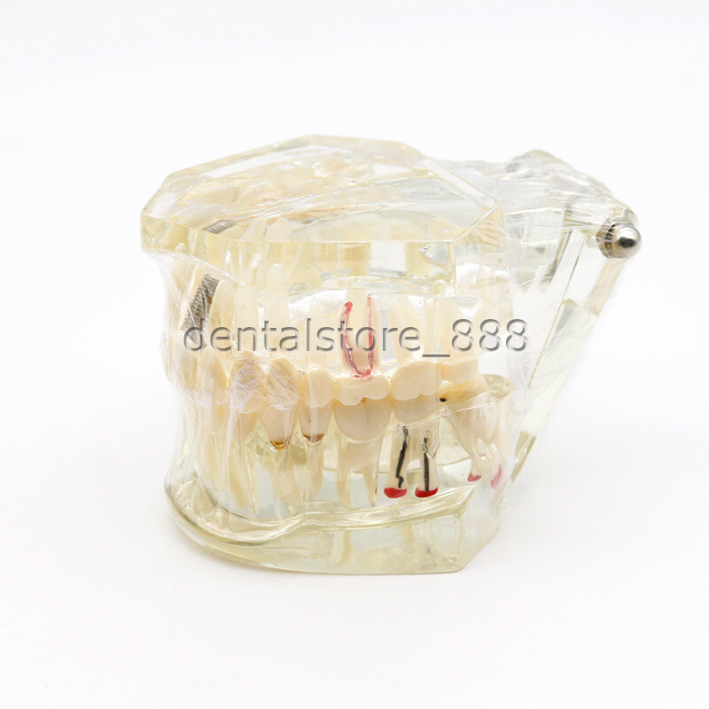 3D Human Teeth Gums Model Dentist Training Teaching Education