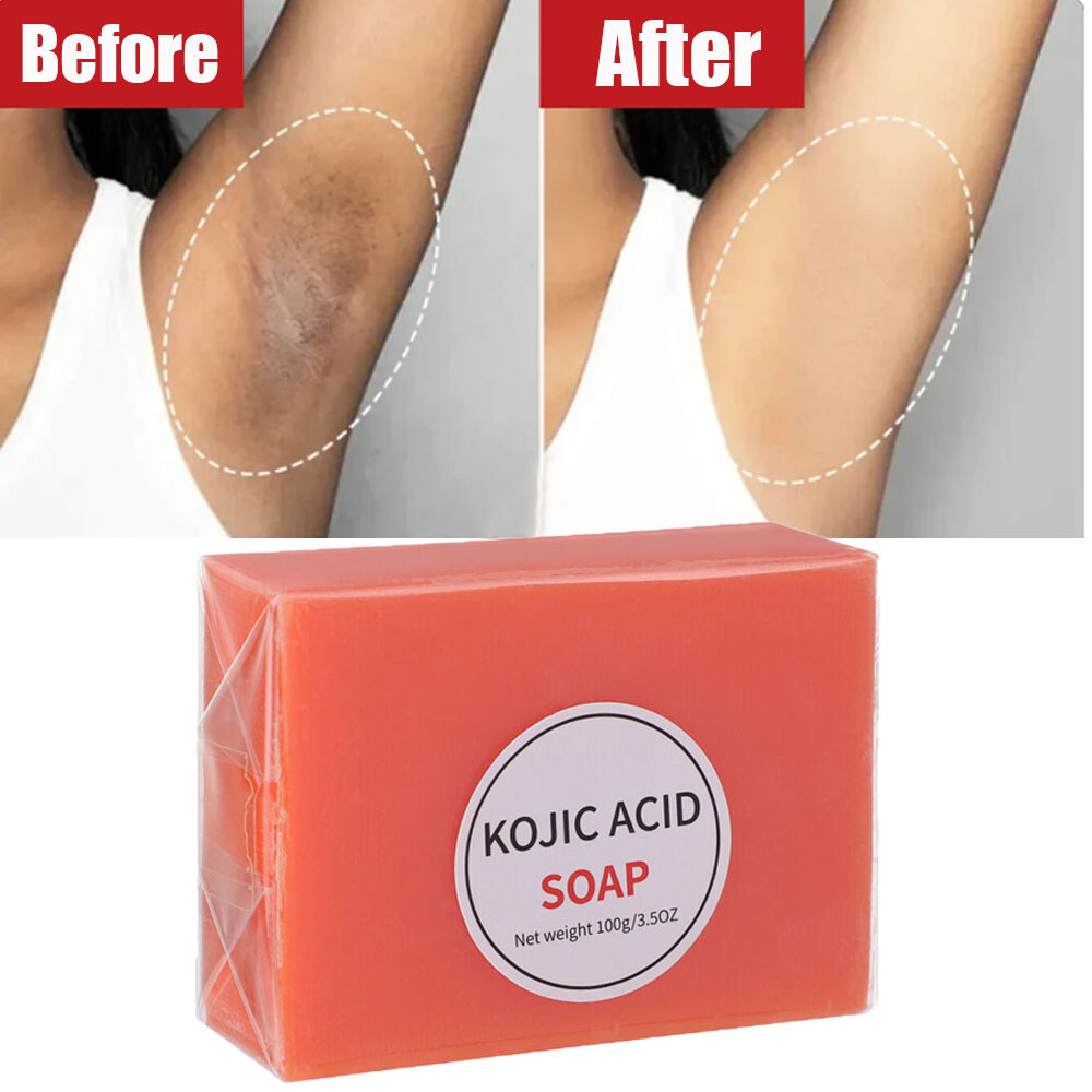 Kojic Acid Soap Dark Skin Whitening Bleaching Lightening Brightening Face & Body
