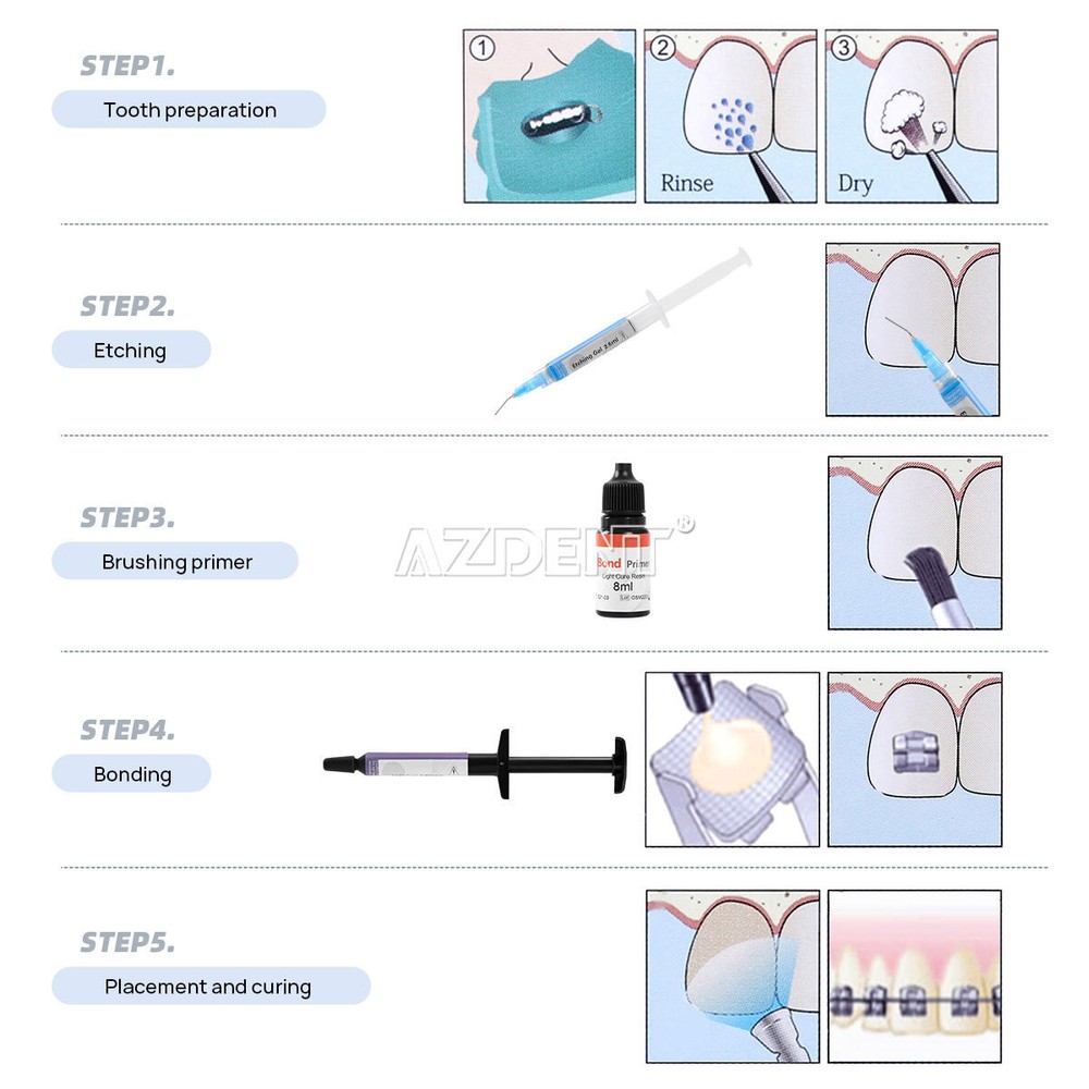Dental Ortho Bracket Cure Light Composite Etching Adhesive Etching Gel Kit