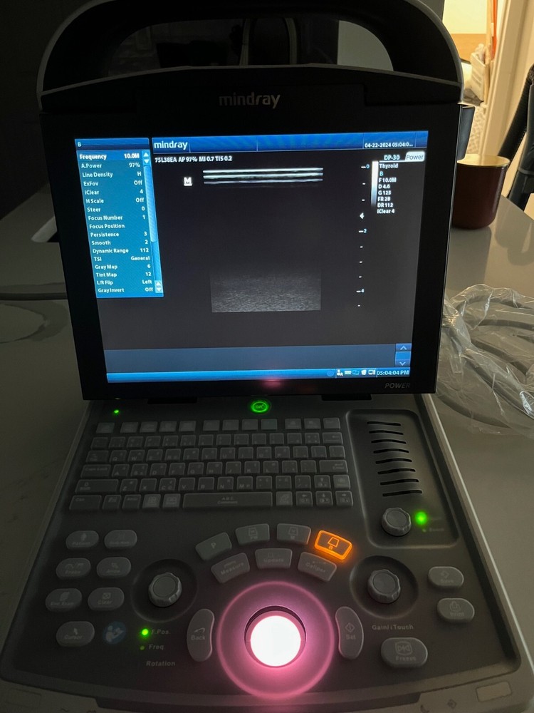 Mindray DP-30 Ultrasound System Model 2020