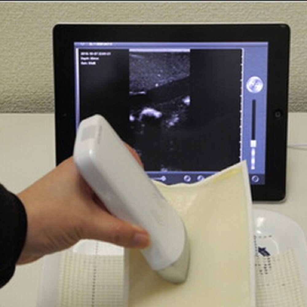 Portable 80 Elements Linear Array Wireless Ultrasound Probe Multi-OS Compatible