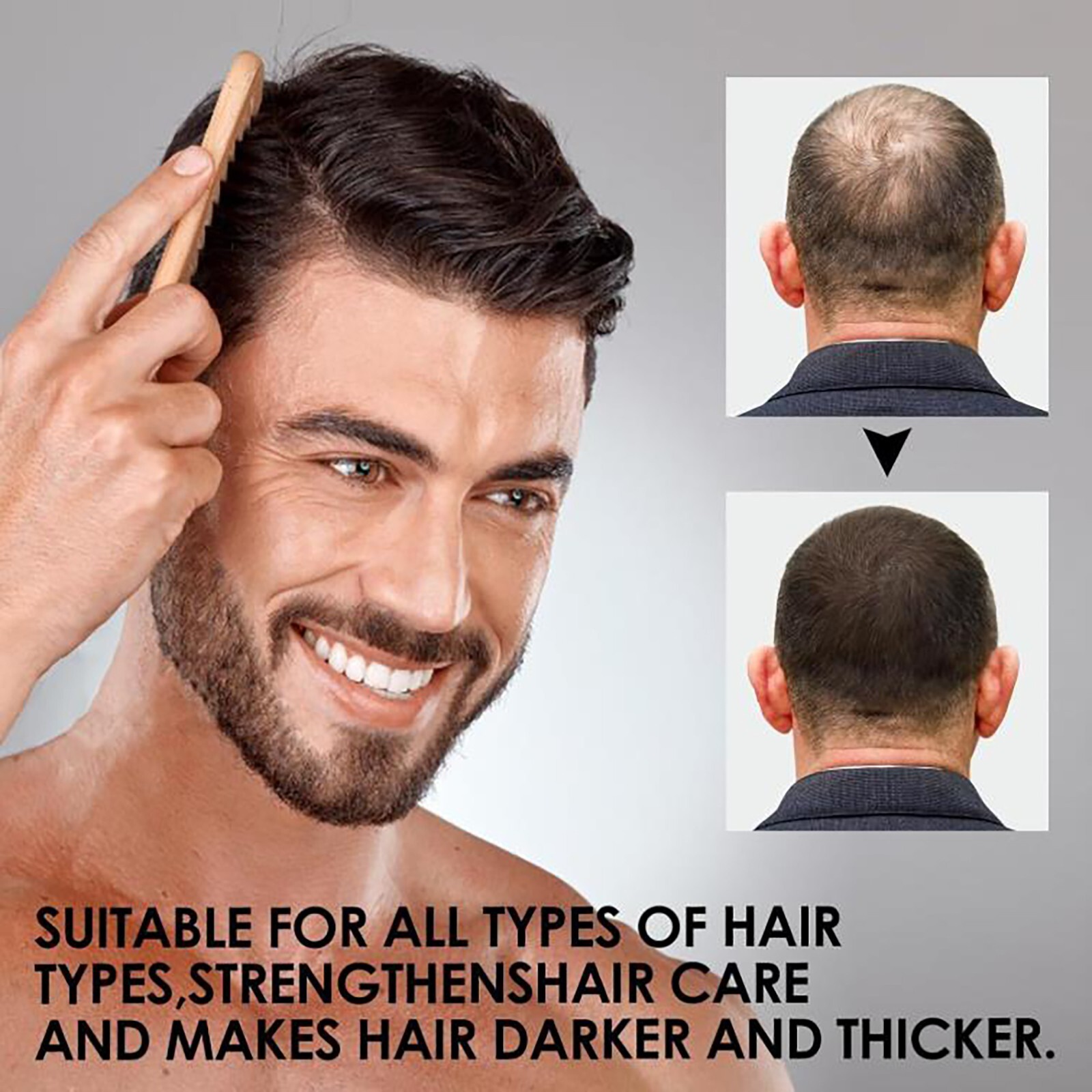 Root Activator Shampoo SPARTAN Hair Loss Shampoo Root Activator ( 200ml ) USA