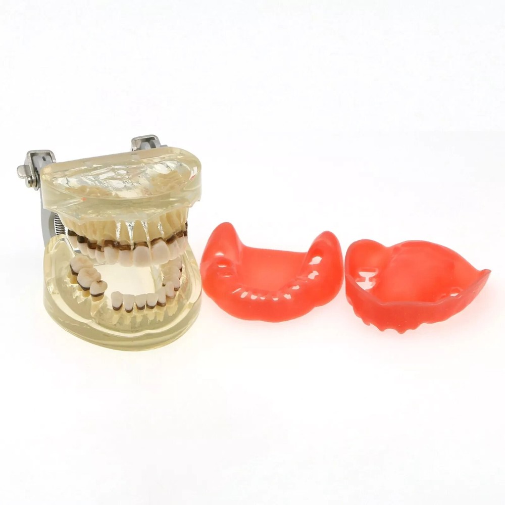 Dental Teeth Model Pathological Disease M4017 Removable Teaching Study Model