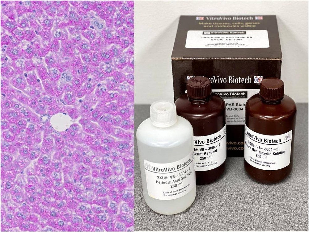 VitroView™ PAS Stain Kit (Cat#VB-3004)