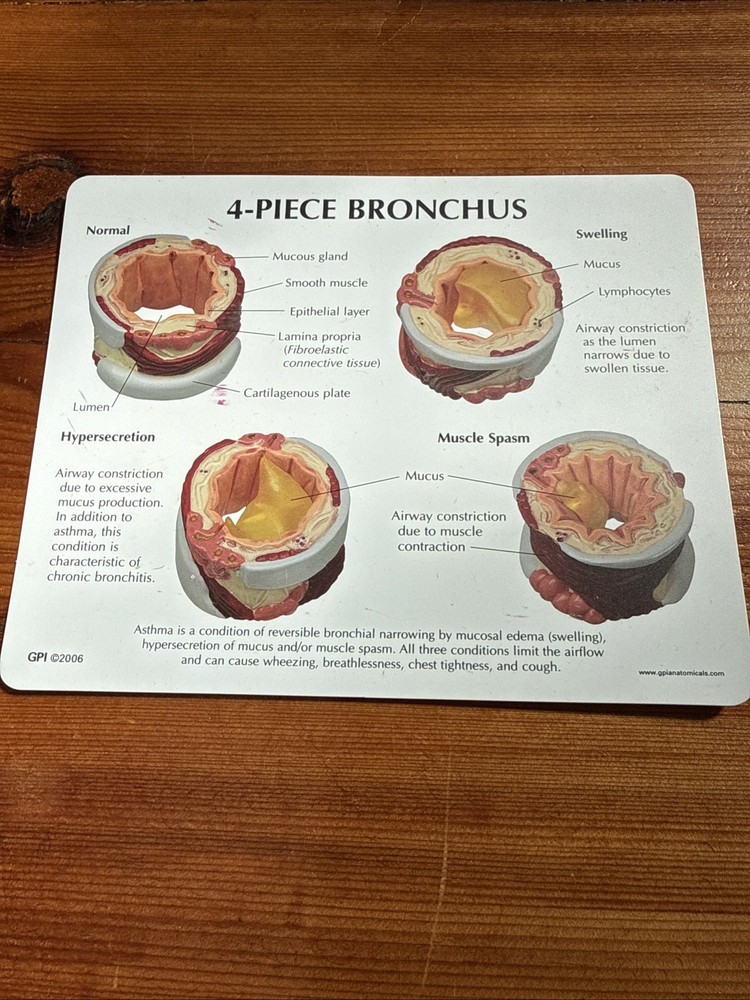 Bronchus GPI Anatomical Model 4-Piece With key