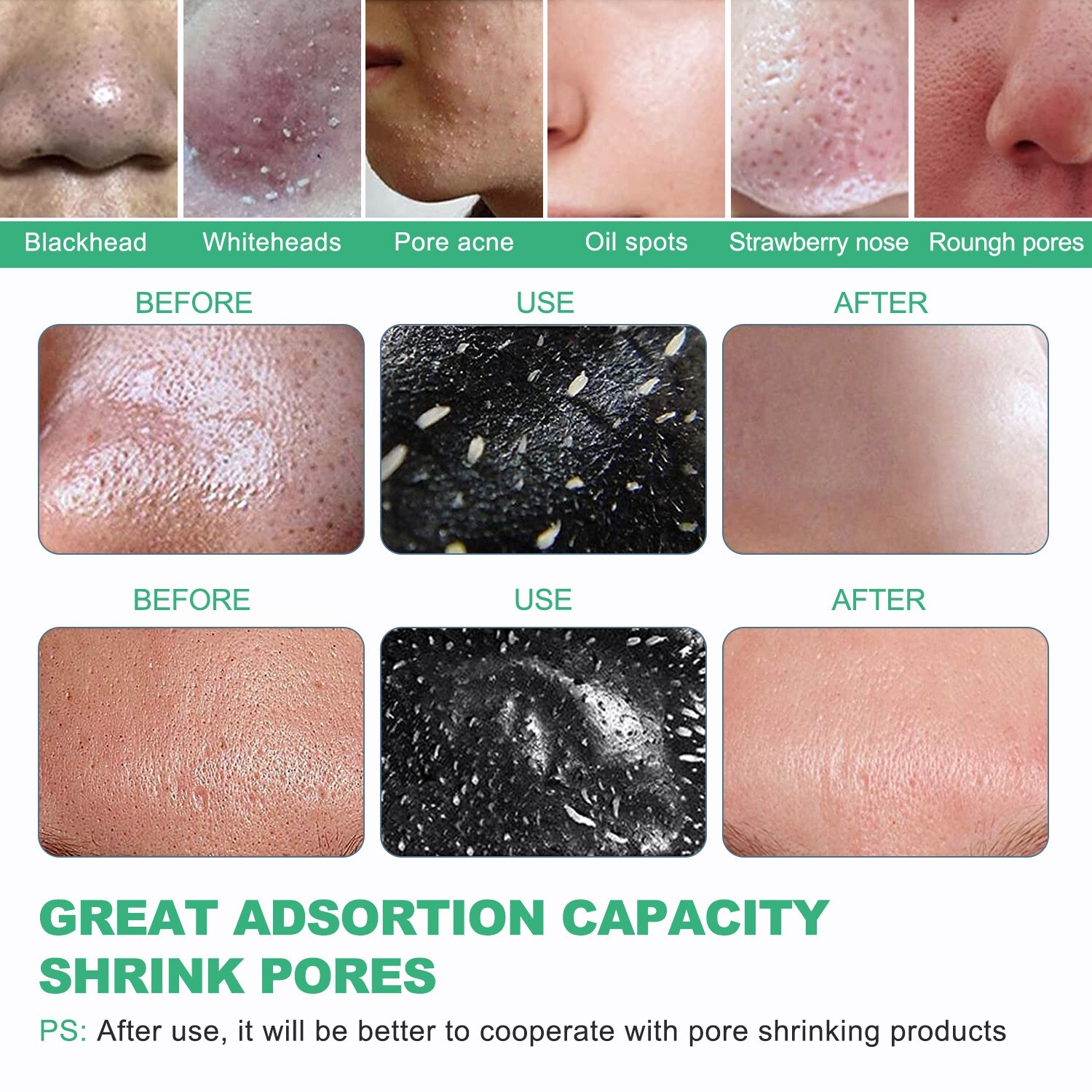 Acne Peel-off Mask - Charcoal Facial Cleanser for Blackhead Removal & Clear Skin