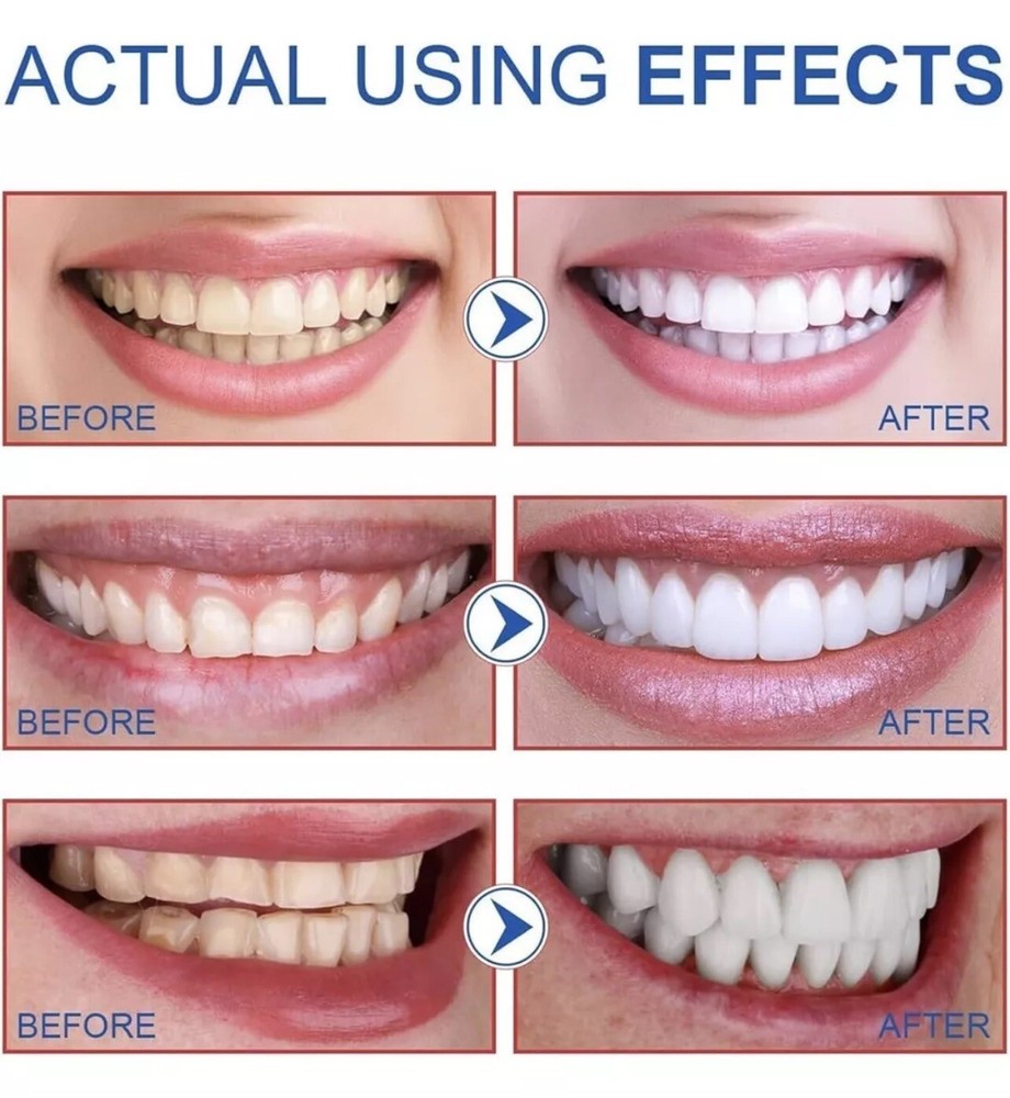 4Pcs Super Probiotic SP-6 Toothpaste