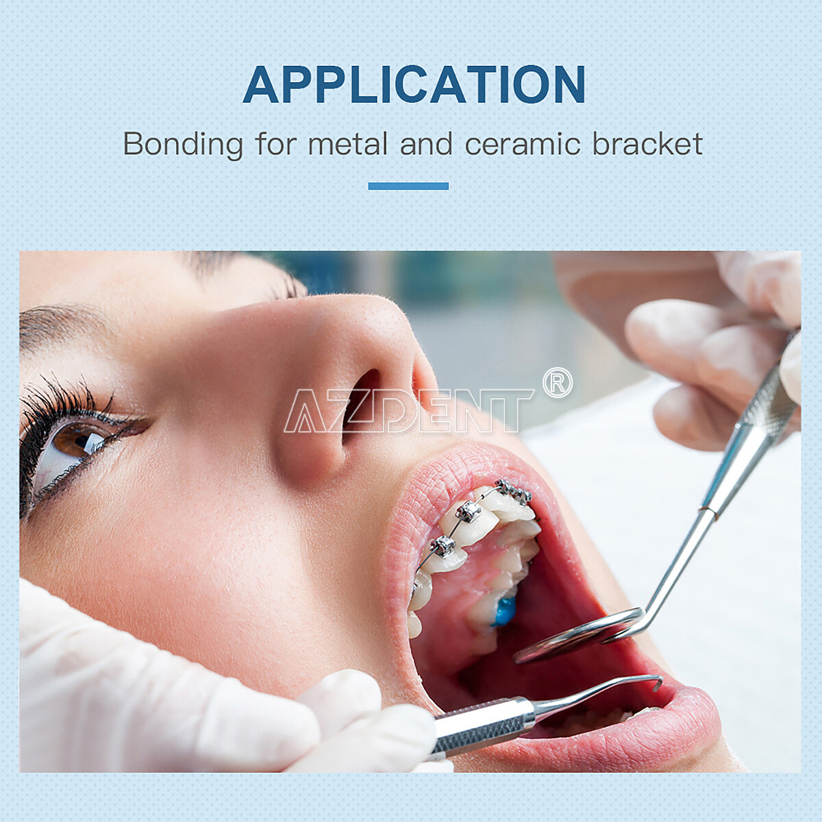 Dental Glue Ortho Bonding System Light Cure Primer Adhesive Kit For Brackets