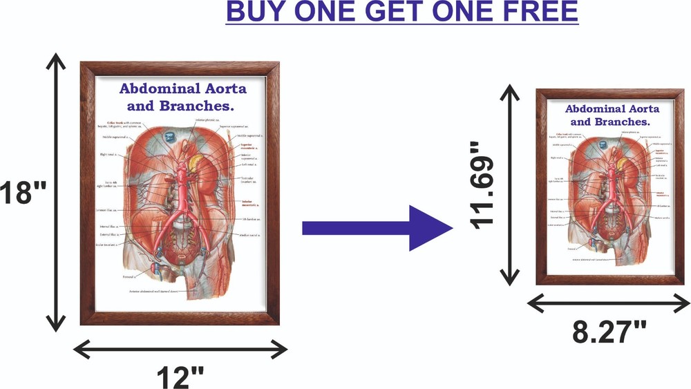 Abdominal Aorta and Branches Chart 12x18 inches