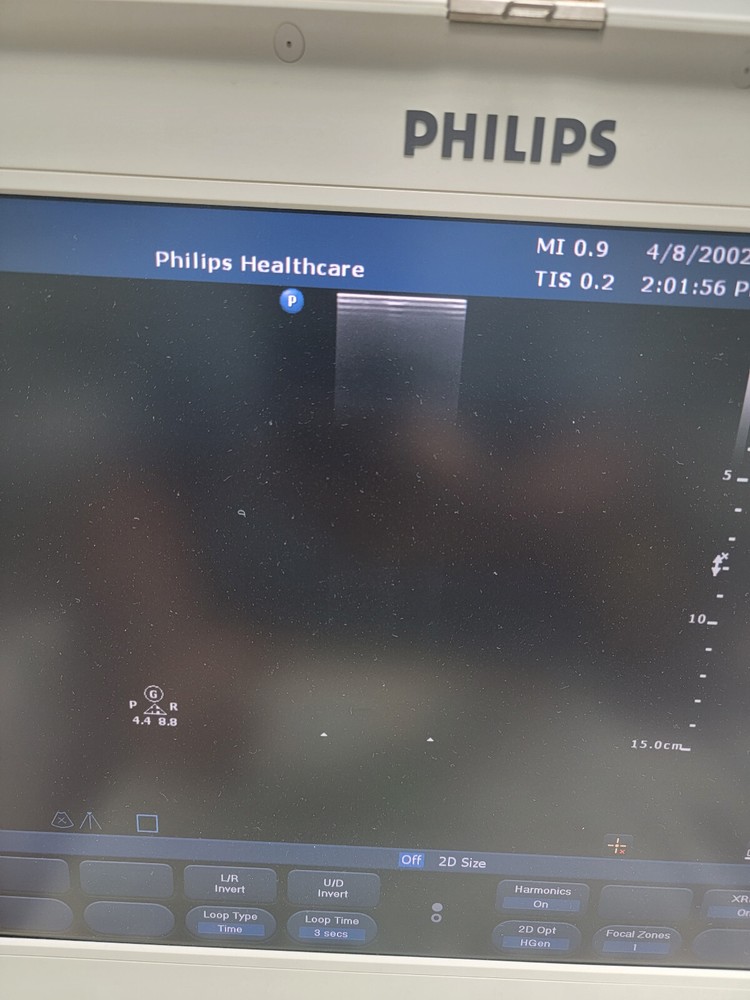 Portable Ultrasound