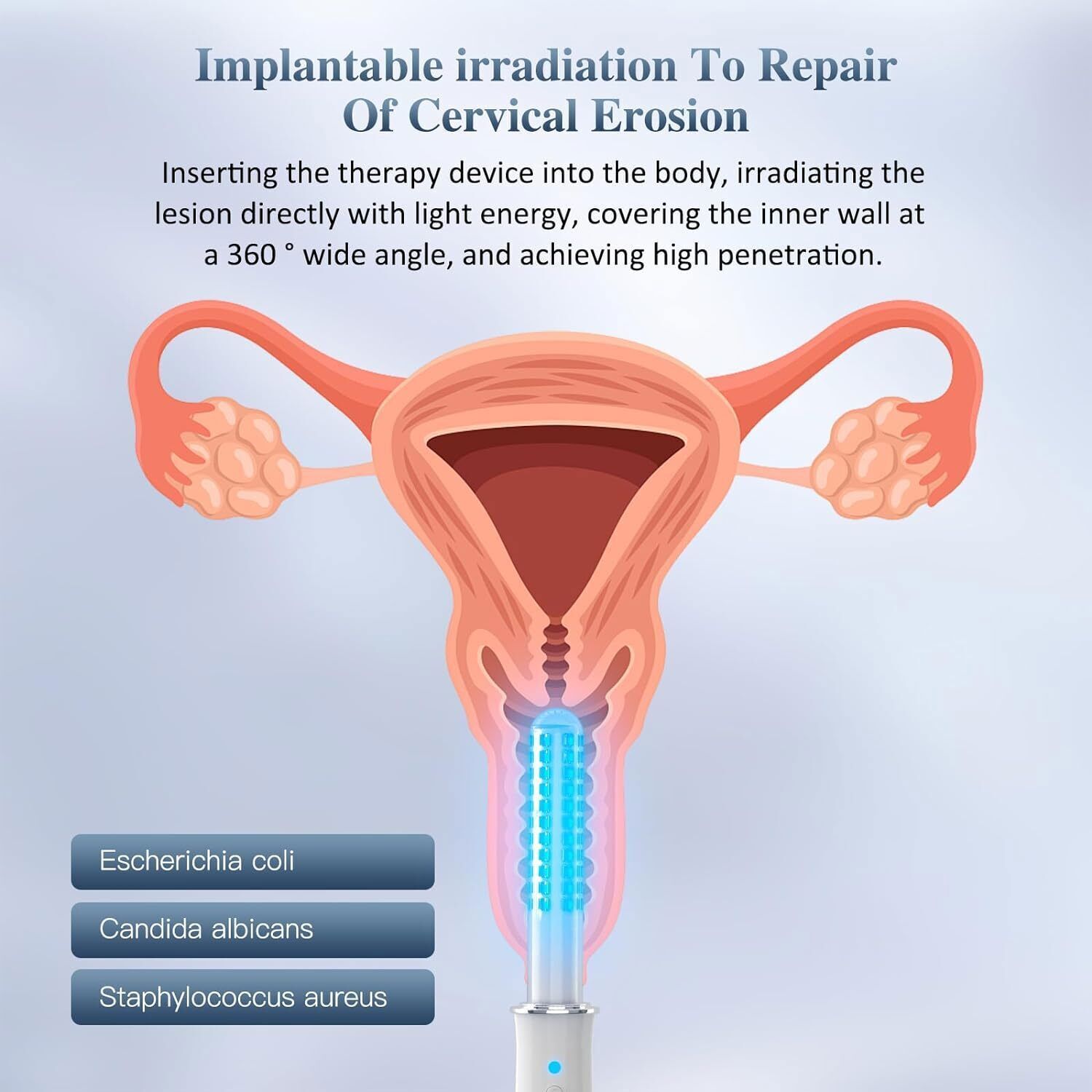 Red & Blue Light Gynecological Therapy Vaginal Rejuvenation Wand Intimate Health