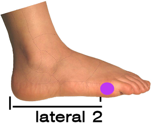 Foot Arch support - Pre-made POLYpropylene size 5 - 13, optional cover flat heel