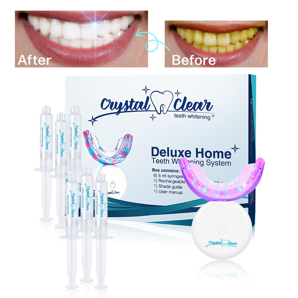 Kit Blanqueamiento Dental Calidad DDS. Recargable