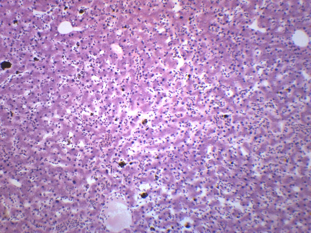 Frog Liver, Section - Prepared Microscope Slide - 75x25mm - Eisco Labs