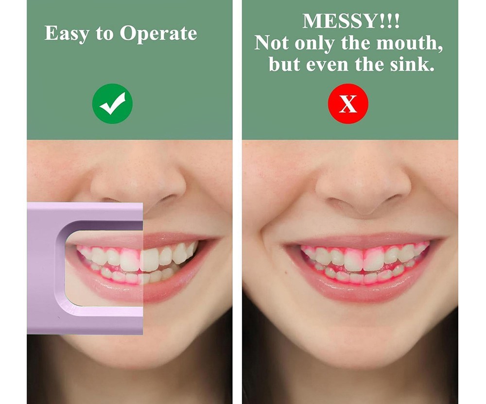 Electric Dental Plaque Indicator Detector Display Device Oral Hygiene Care Pink