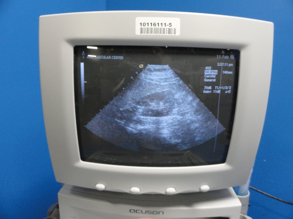 Siemens Acuson 4V2 Vector Array Ultrasound Transducer/Probe W/ Case ~ 8592