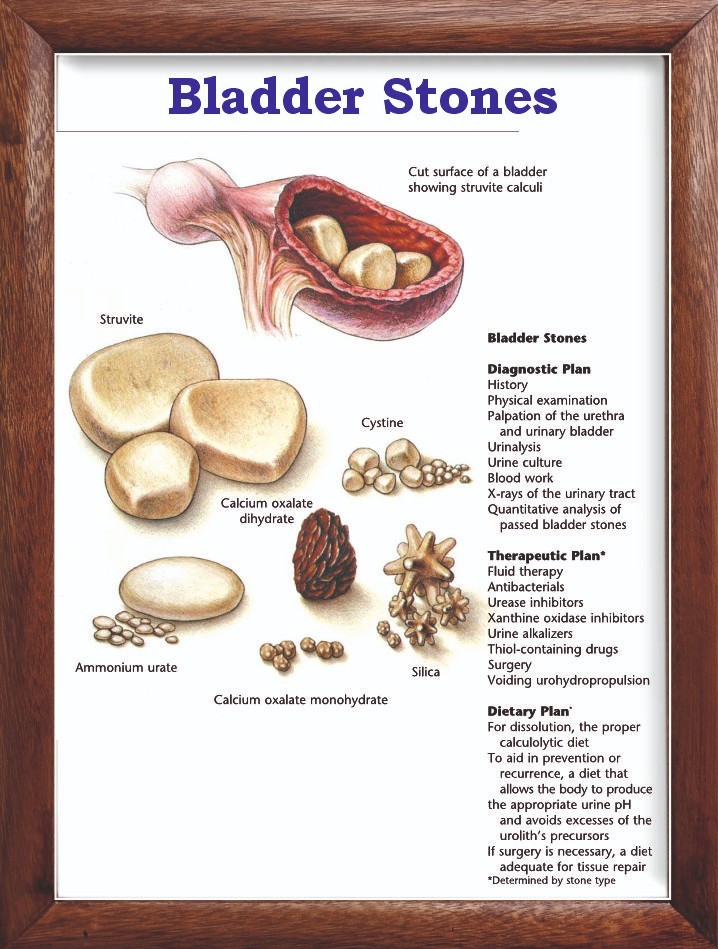 Bladder Stones Chart 12x18 inches