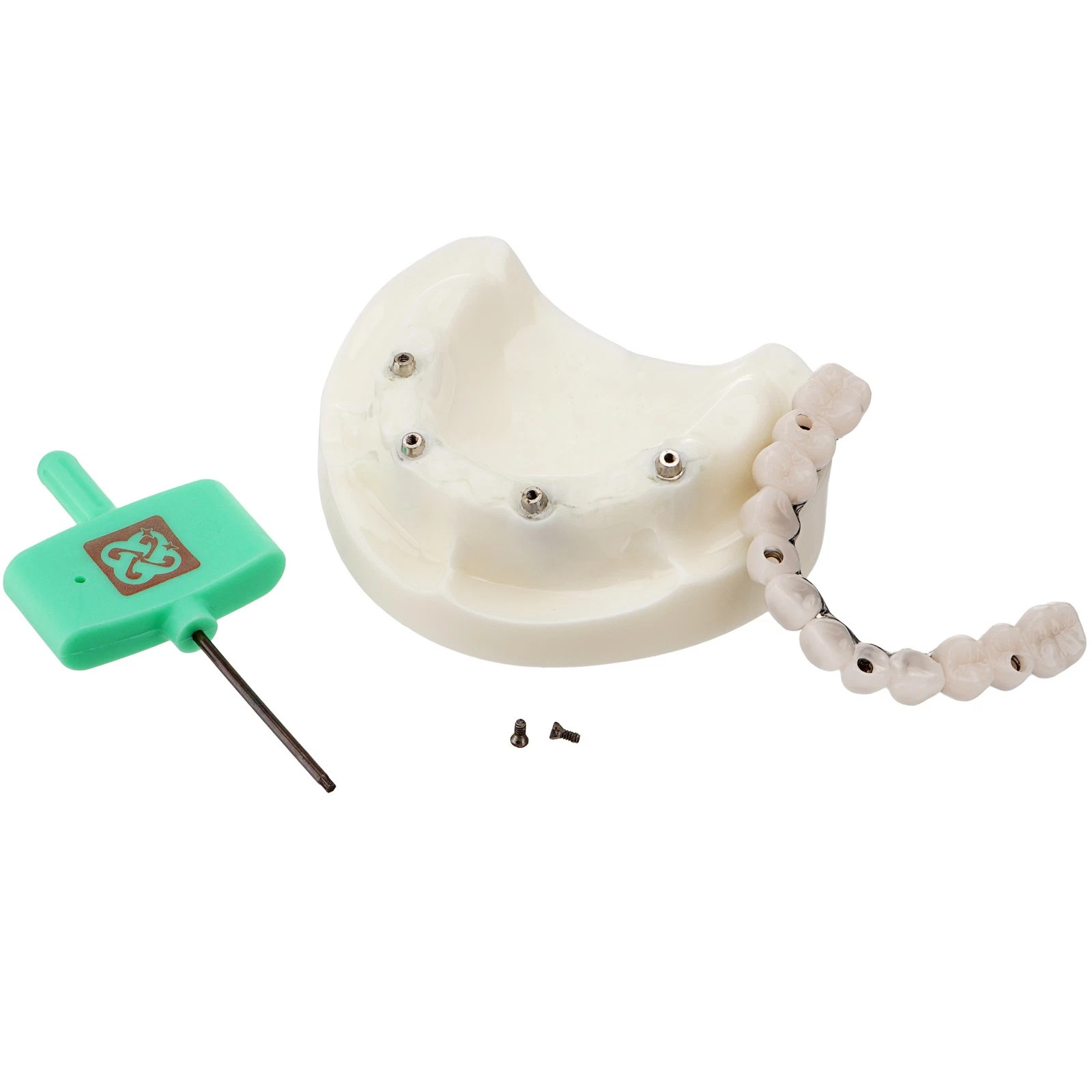 Dental All-on-4 Overdenture Model Dental Upper Jaw Implants Restoration 4 Screws