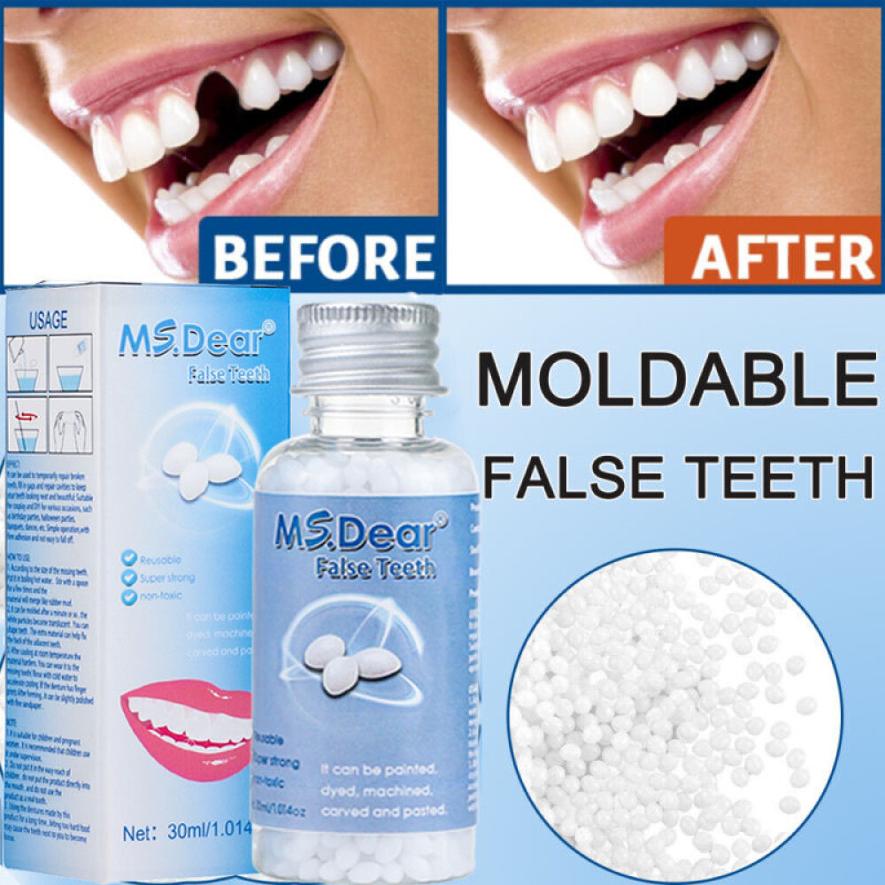 False Teeth Solid Glue Temporary Tooth Repair Moldable Fix Broke Gap Teeth 30ML