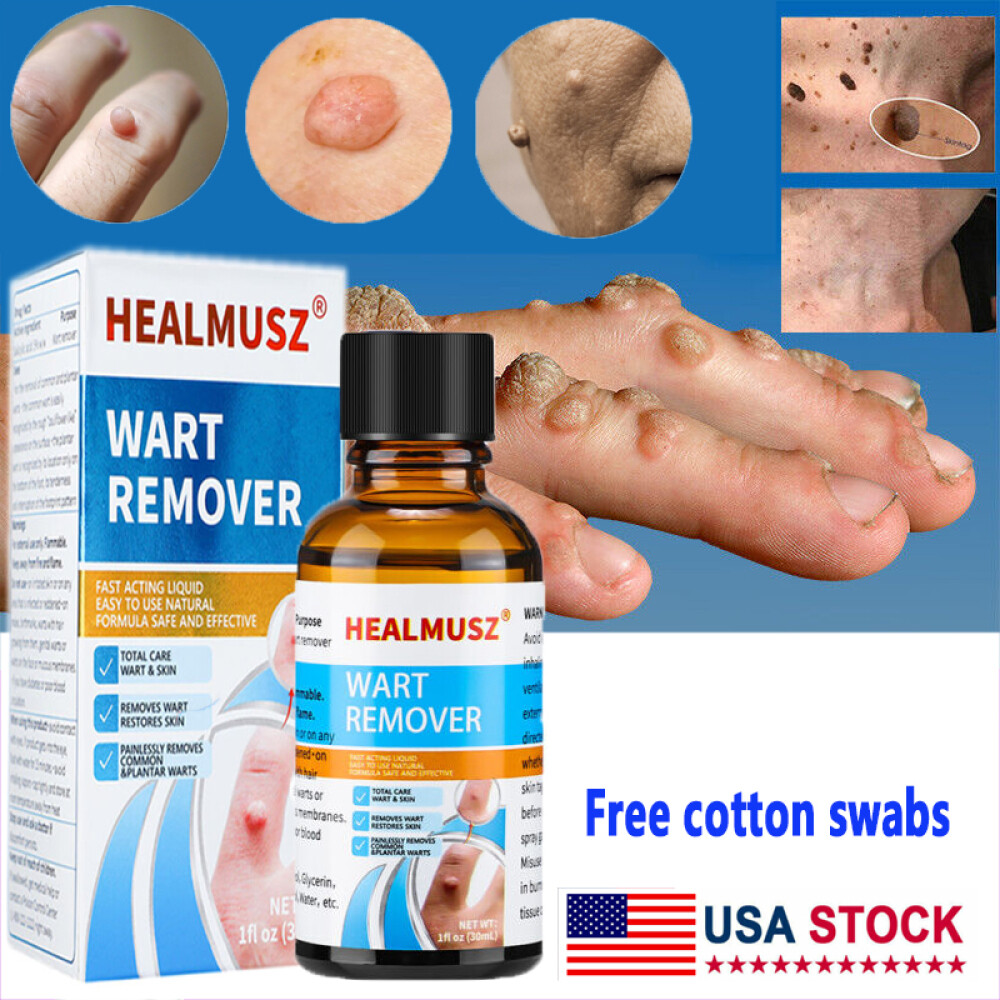 2Pack Wart Remover Liquid Skin Tag Mole Remover Eliminate Feet Corn Wart Remove