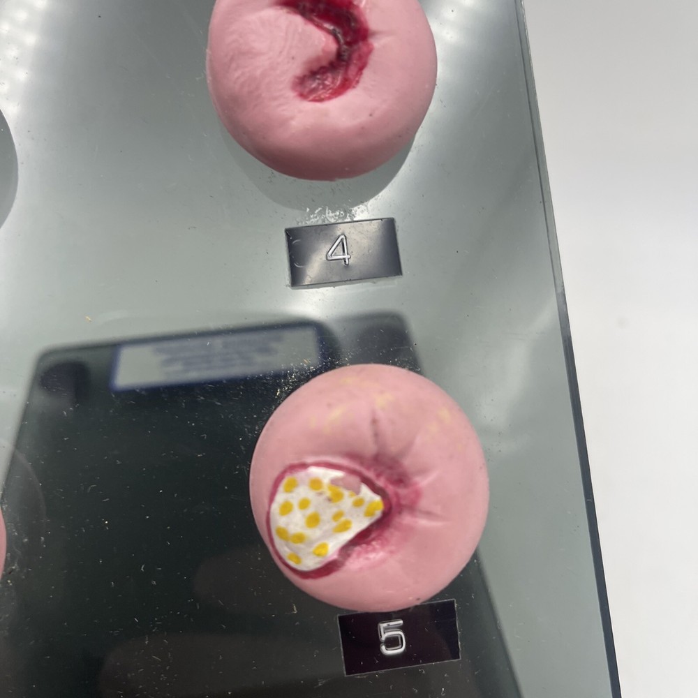Gaumard S505 Cervical Pathologies Model Pathology Anatomical Ob/Gyn Cervix