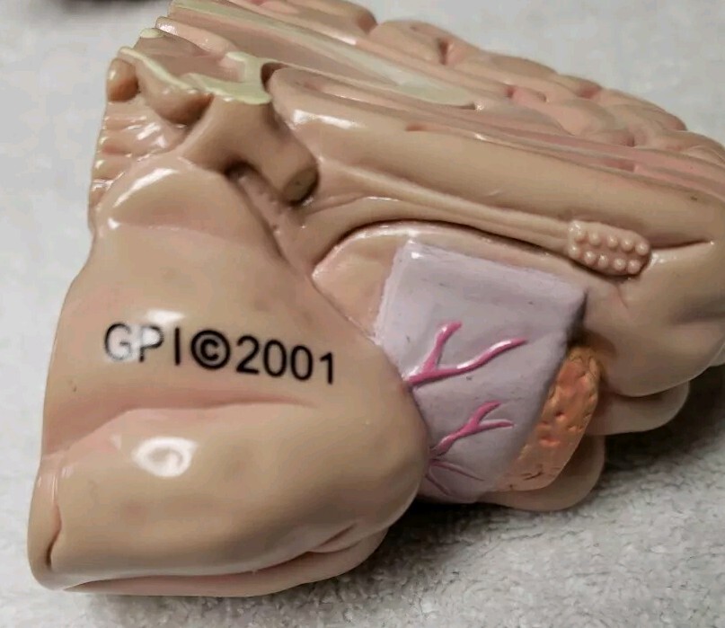 GPI Brain/ Partial Skull Model