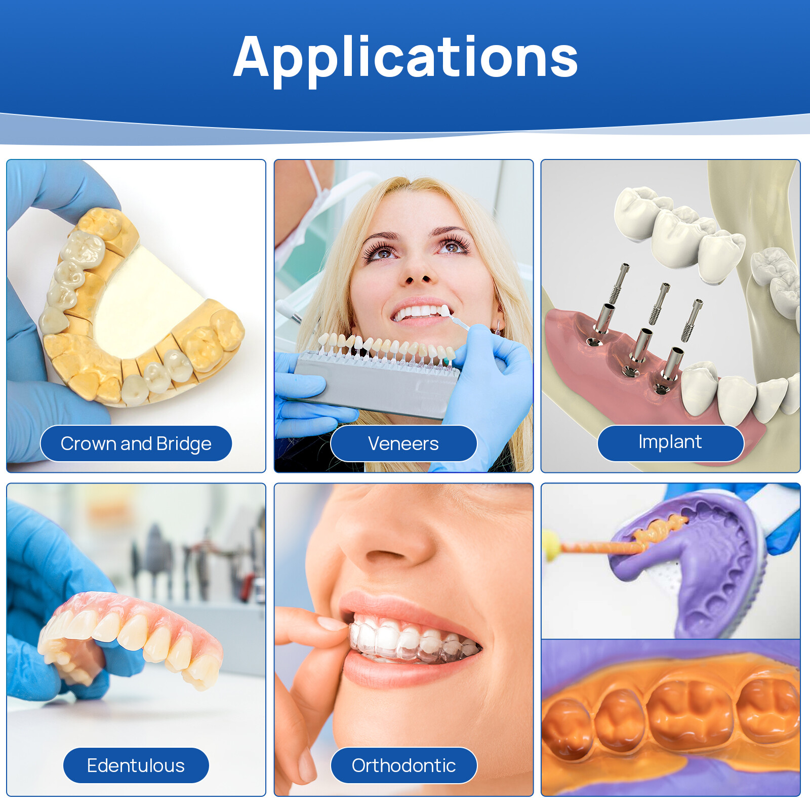 JMU Dental Impression Materials Putty Fast/Normall Set 400g Base+400g Catalyst