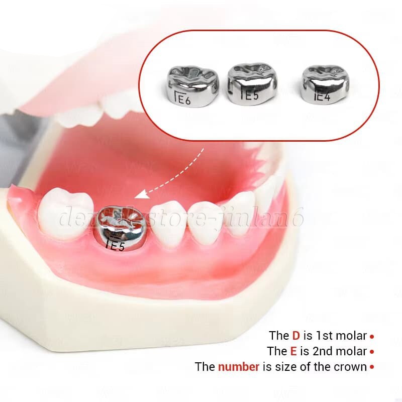 48 ASSORTED PRIMARY MOLAR STAINLESS STEEL CROWNS - COMPLETE KIT